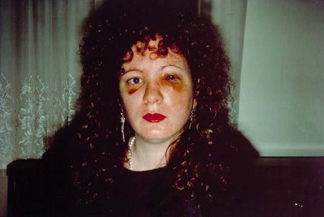 Nan Goldin, “Nan One Month After Being Battered, 1984,” silver dye bleach print, printed 2008 (the Museum of Modern Art, New York. Purchase)